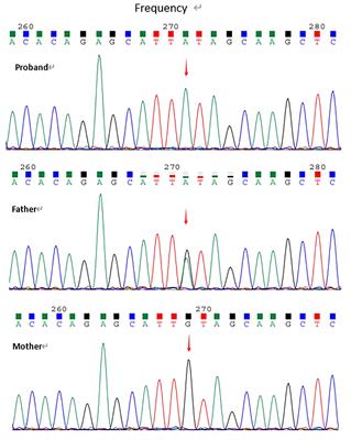 Case report: A case of novel homozygous LRBA variant induced by chromosomal segmental uniparental disomy - genetic and clinical insights